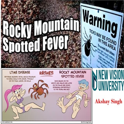 Rocky mountain spotted fever