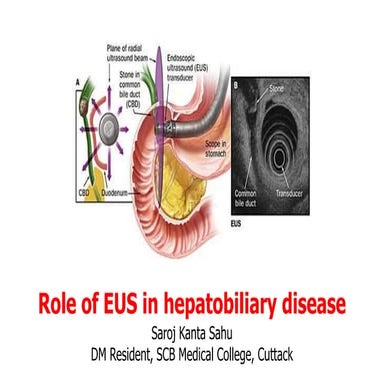 Laparoscopic CBD Exploration | PDF