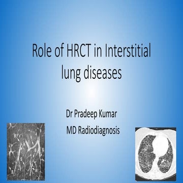 Role of hrct in interstitial lung diseases pk upload