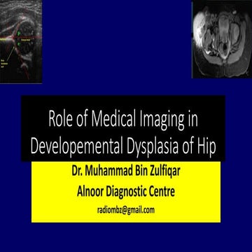 Role of medical imaging in developemental dysplasia of Hip Dr muhammad Bin Zu...