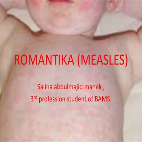 Romantika (measles)
