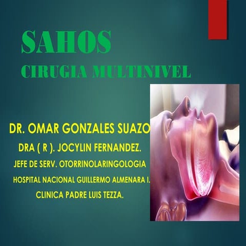 RONCOPATIA: SAHOS - CIRUGIA MULTINIVEL. | PPT