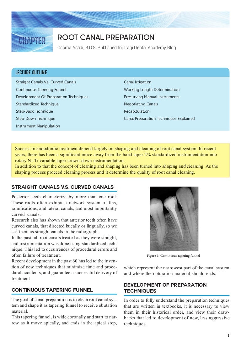 Root Canal Preparation Basics