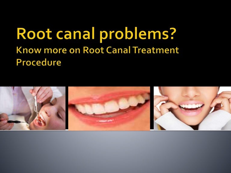 Root canal problems? know more on root canal treatment procedure