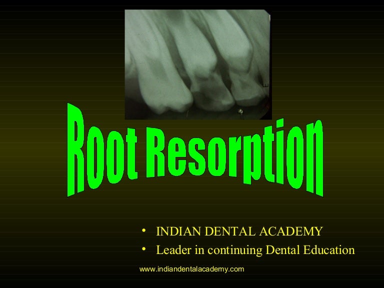 Root resorption/ dental courses