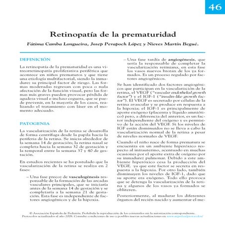 MELANOMA OCULAR( DE COROIDES) | PPTX
