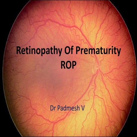 ROP  - Dr Padmesh - Neonatology