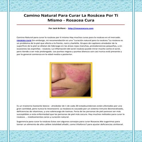 Rosacea cura | PDF