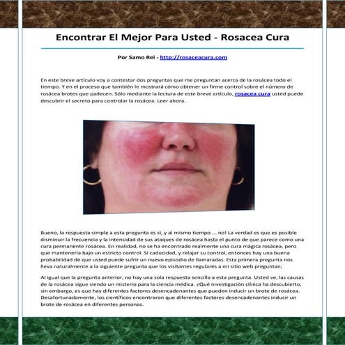 Rosacea cura | PDF