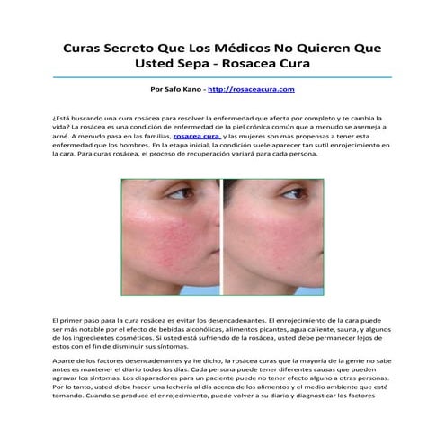 Rosacea cura | PDF