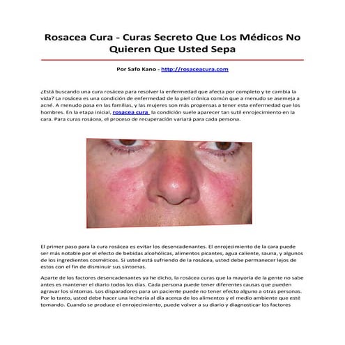 Rosacea cura | PDF