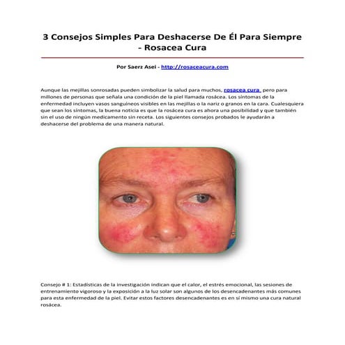 Rosacea cura | PDF