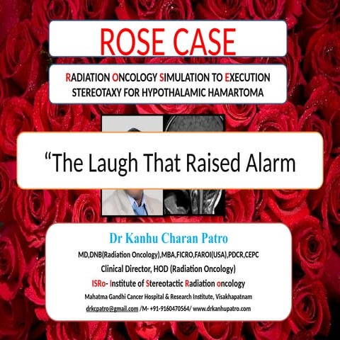 ROSE  CASE SRS FOR HYPOTHALAMIC HAMARTOMA BY DR KANHU CHARAN PATRO