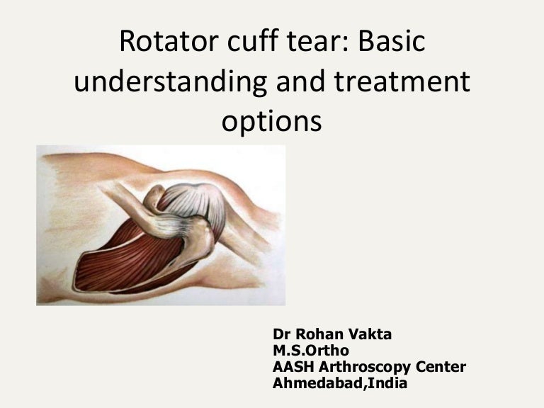 Rotator cuff Tear and its management