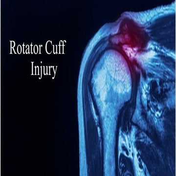Comprehensive Overview of Rotator Cuff Injury: Anatomy, Diagnosis, and ...