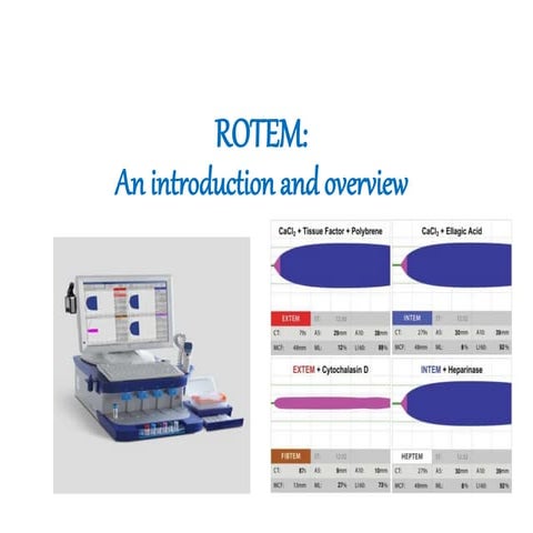 ROTEM - An Introduction and overview.pptx