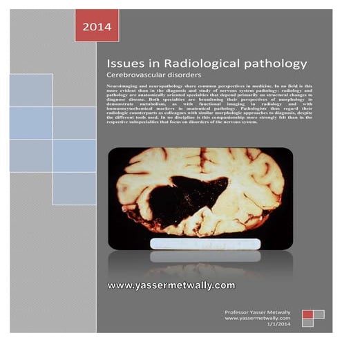 Radiological pathology of cerebrovascular disorders