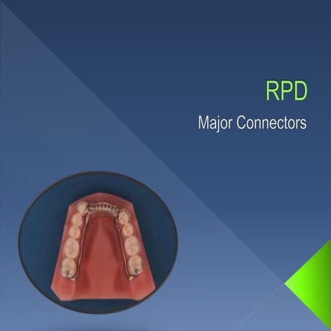 RPD Major Connectors 
