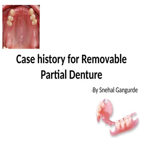 Case History and Clinical Procedures for Removable Partial Dentures in ...
