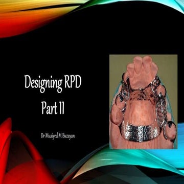 removable partial denture RPD design part 2 