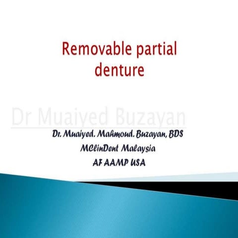 Rpd removable partial denture introduction 2nd yr | PPTX