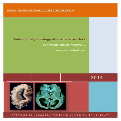 Radiological pathology of epileptic disorders