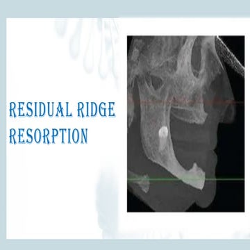 RRR-PPT.pptxgvahedjakljdkajcbcbjdcbnlEWIDJOIWEHF