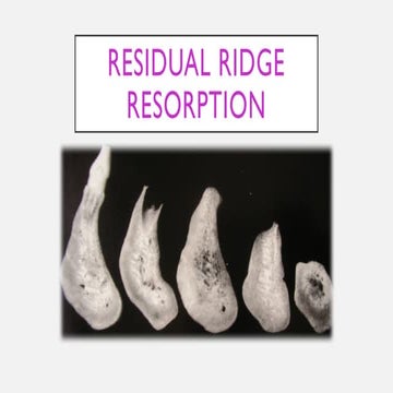 Residual ridge resorption | PPTX