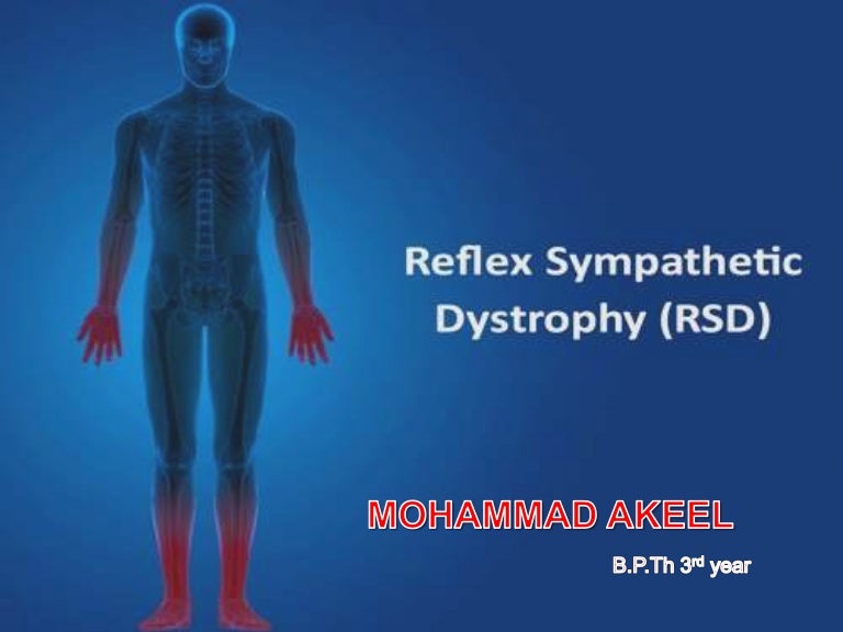 RSDREFLEX SYMPATHETIC DYSTROPHY