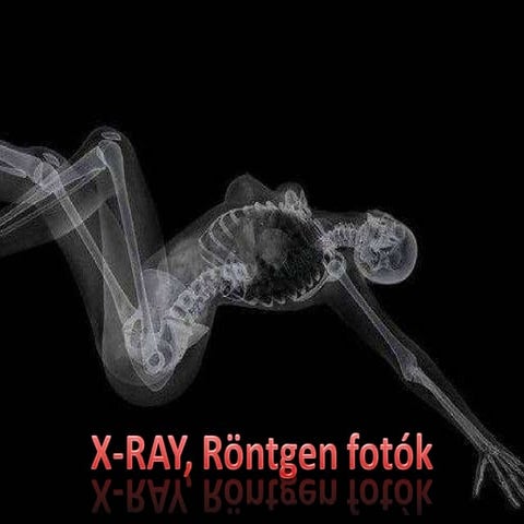 Rtg - X-ray - fotók | PPS