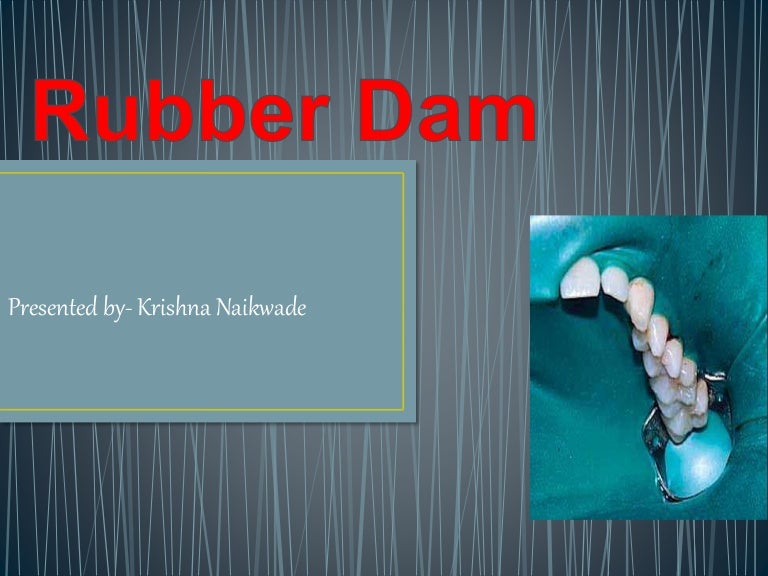 Rubber dam
