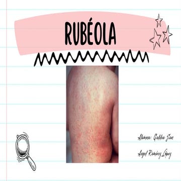 GRUPO 4 RUBEOLA.pptx