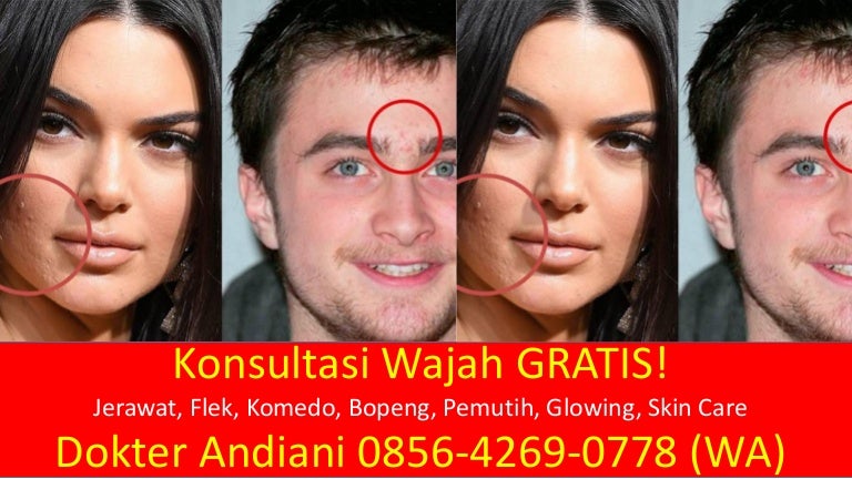 Get Rumah Cantik Amzafy Background