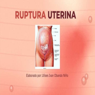 Ruptura Uterina.pptx