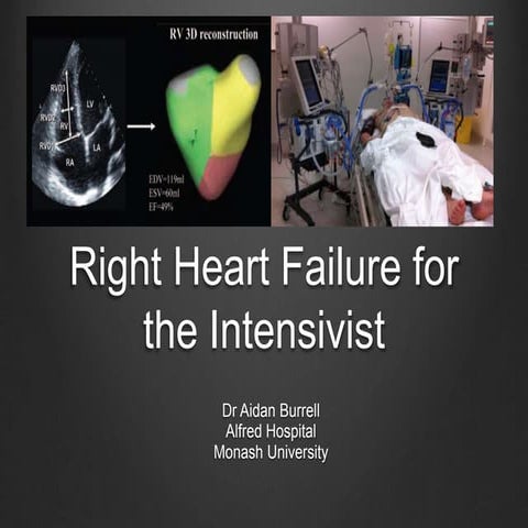 ICN Victoria: Burrell on "RV Failure for the Intensivist"