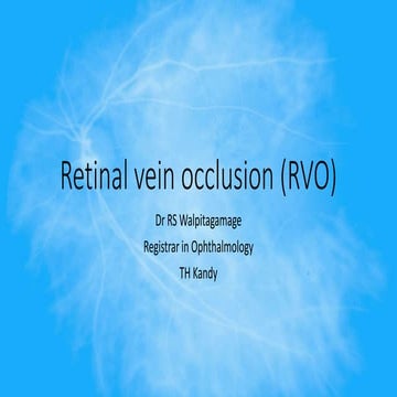 Retinal Vein Occlusion | PPTX