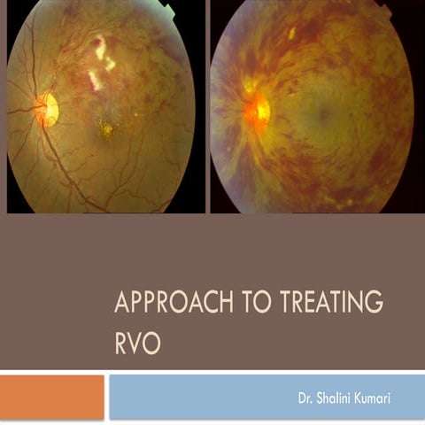 RVO.pptx management different studies, intravitreal injections | PPTX