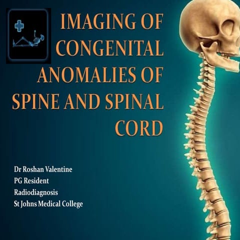 Congenital Anomalies Of Spine And Spinal Cord