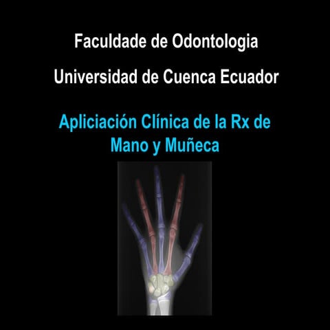 Rx de Mano y Muñeca | PPT
