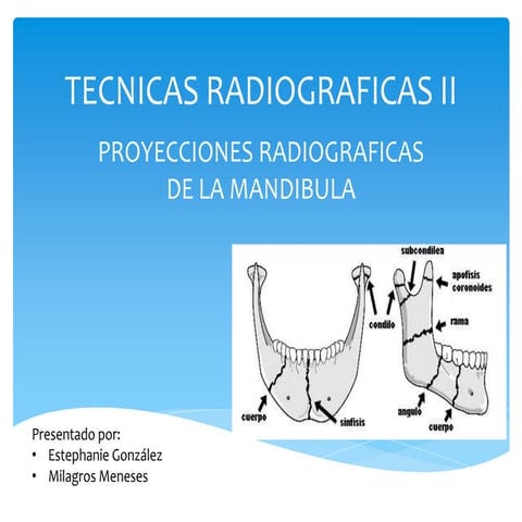 Rx de mandibula | PPTX