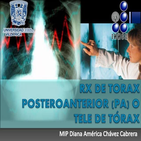 Interpretacion de radiografia PA de torax o tele de torax