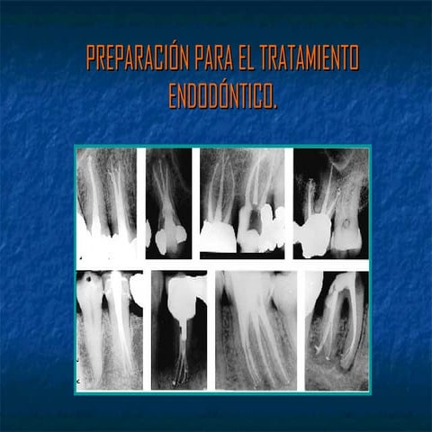 Rx endo 6 b | PPT