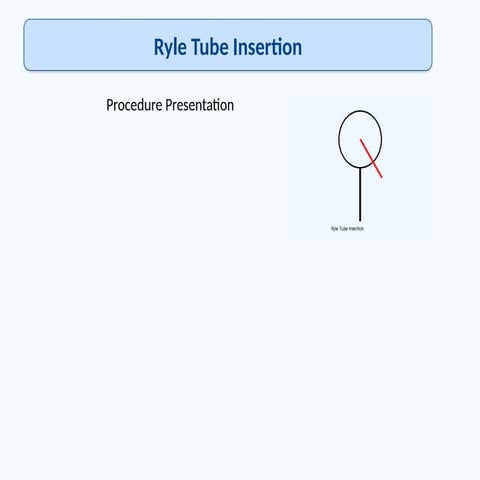 Comprehensive Guide to Ryle Tube Insertion Procedure in Nursing | PPTX