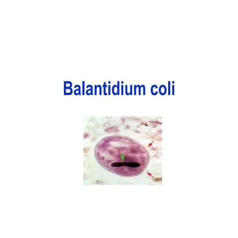 Parasitologia - Balantidium coli | PPT
