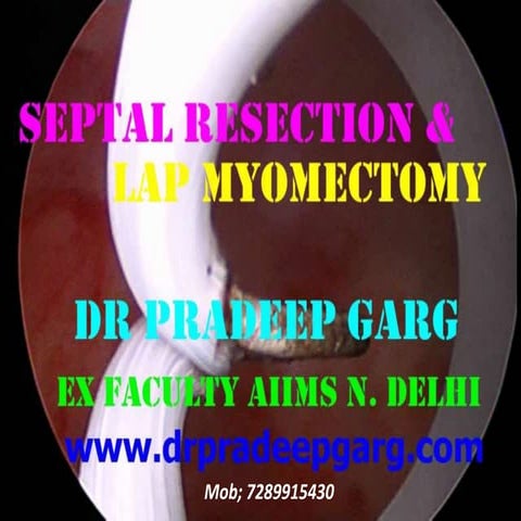 Septal Resection & Lap Myomectomy : Dr Pradeep Garg