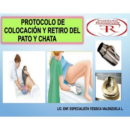 S13 -INTERVENCIÓN DE ENFERMERÍA EN NECESIDAD DE ELIMINACIÓN URINARIA.pdf