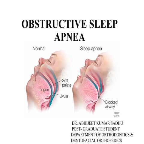 OSA, It wasn't until 1965 that a French group of investigators, Dr. Gastault ...