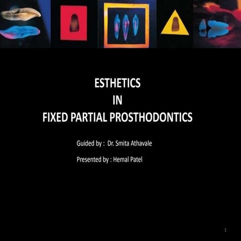 Esthetics in FPD