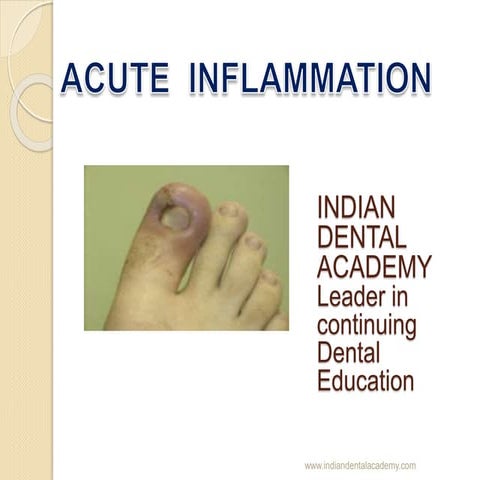 acute inflammation