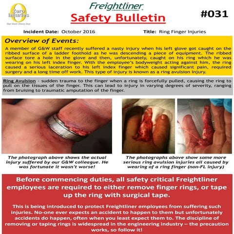 Safety bulletin 031 ring finger injuries